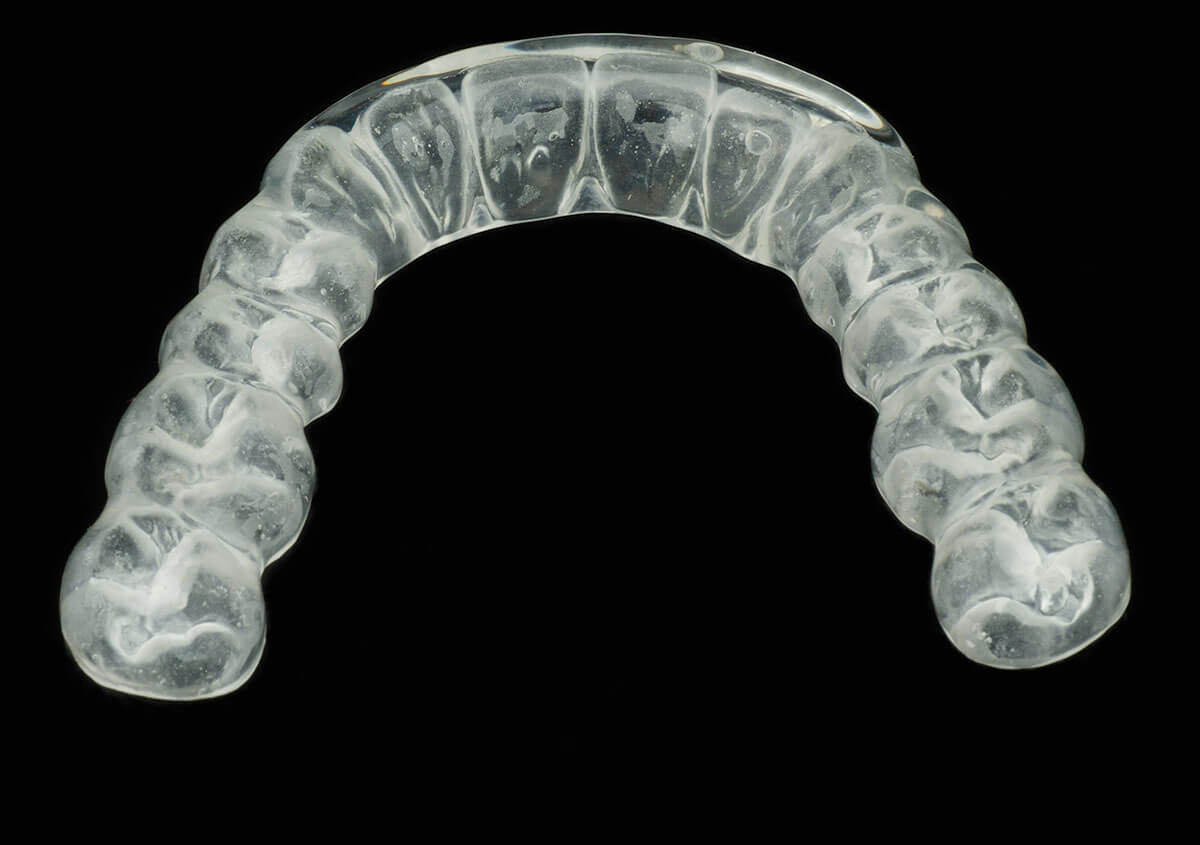 Invisalign For Overlapping Teeth in Peachtree Corners GA Area